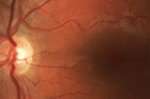 Der Verteilung der Rezeptoren im Auge auf der Spur 